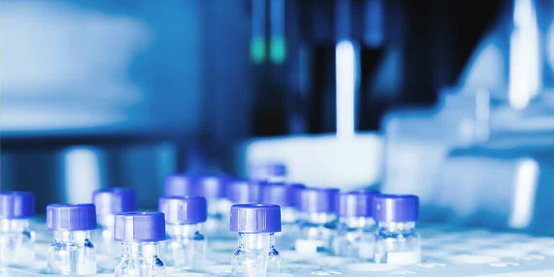 Helsinn SA - Analisi e riorganizzazione della Logistica